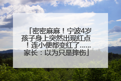 密密麻麻！宁波4岁孩子身上突然出现红点！连小便都变红了……家长：以为只是摔伤